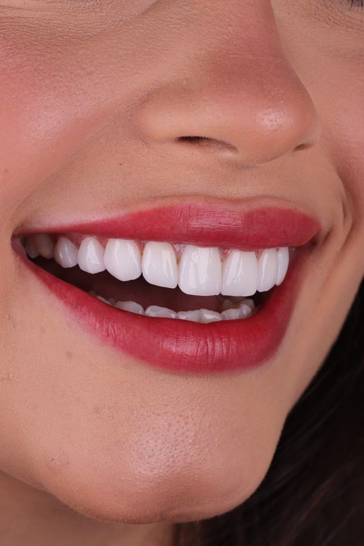 Teeth Whitening FAQ